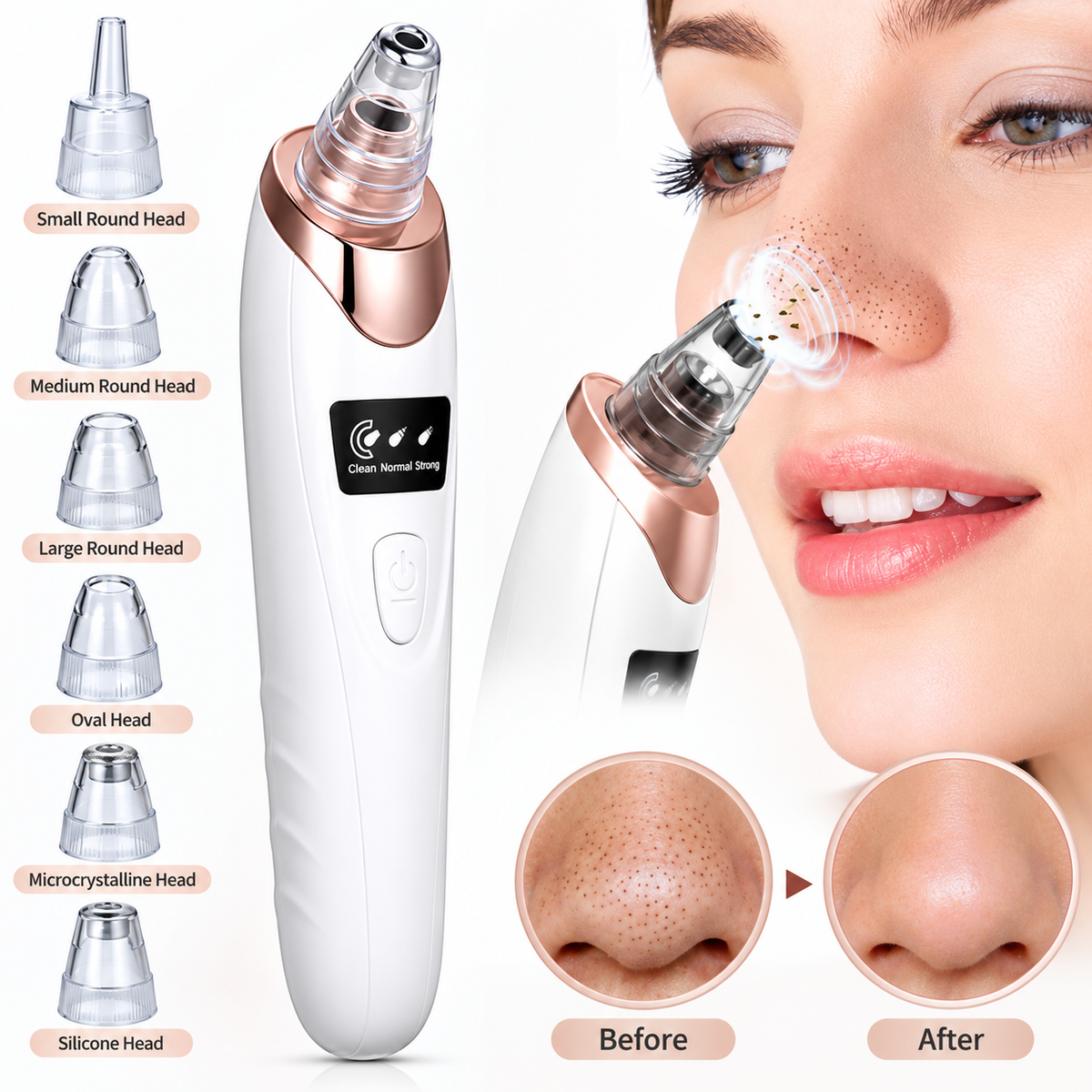 5-in-1 Blackhead Remover Machine | Rechargeable Facial Pore Vacuum